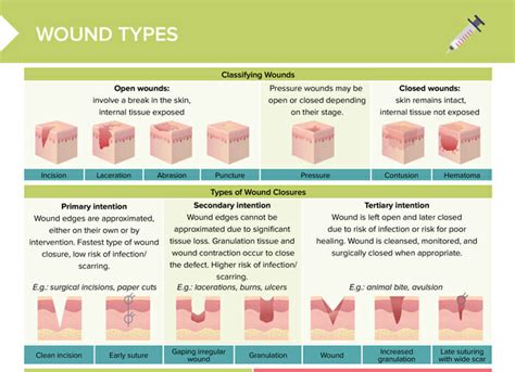 WOUND TYPES & MANAGEMENT .